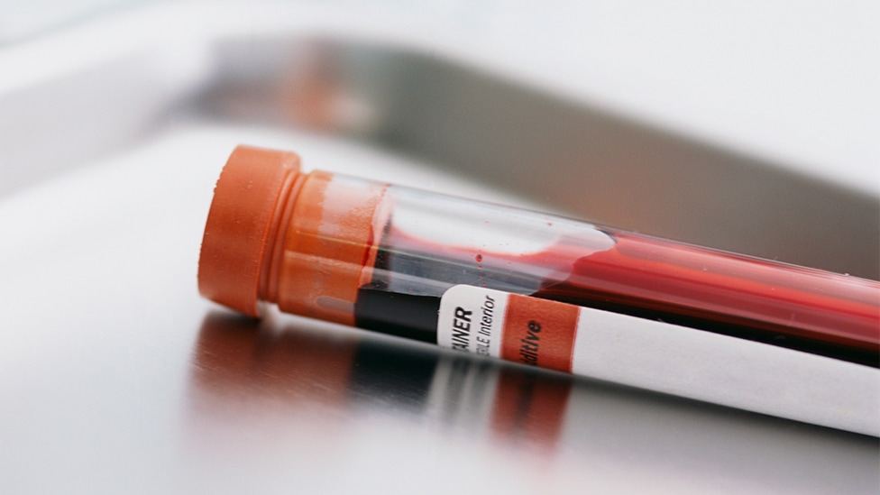 Genetische Bluttests auf Chromosomen-Abweichungen (Quelle: Tom Grill / Corbis / via Getty Images)