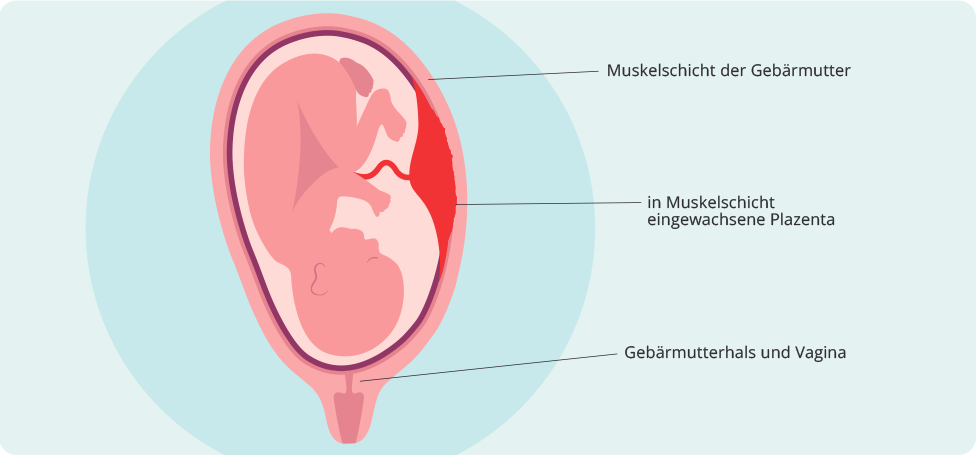 (Quelle: BIÖG)